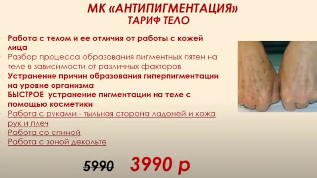 Обложка курса: Антипигментация. Тело [Этель Аданье]. Площадка: Складчик