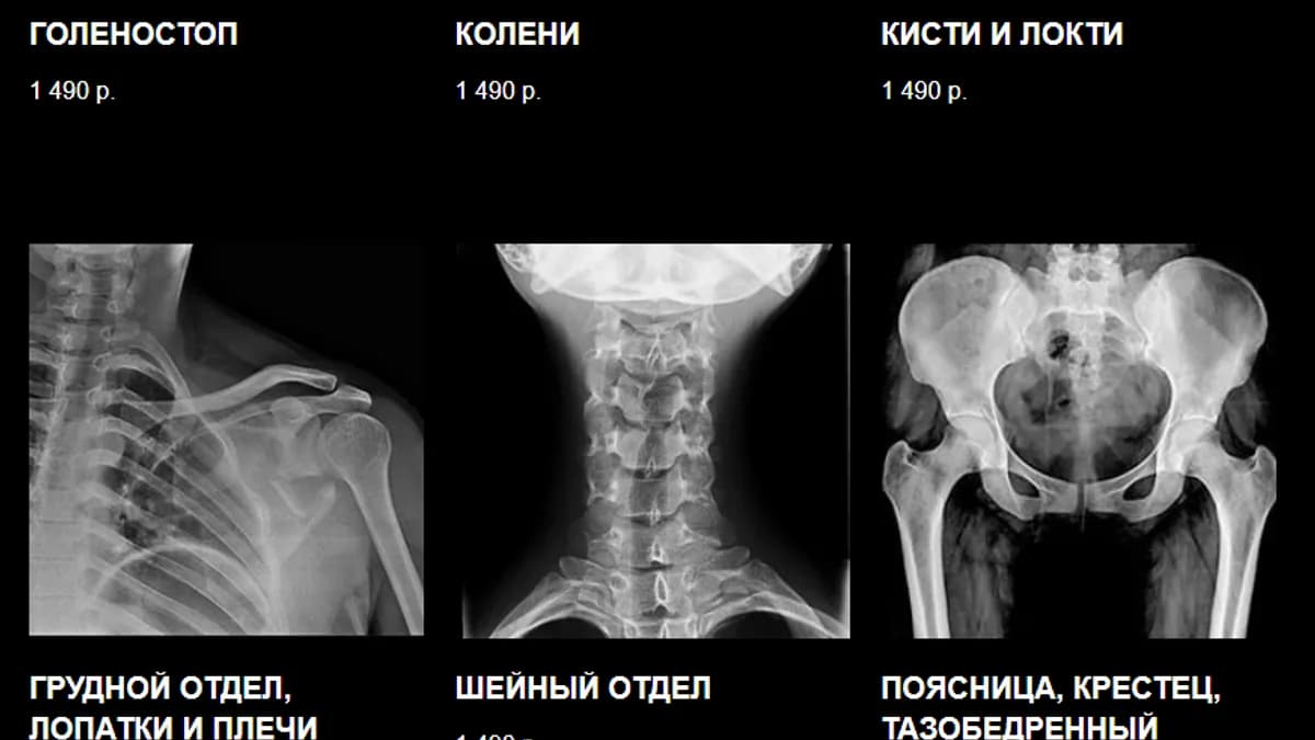 Обложка курса: Полный ЛФК курс [Виктор Блуд, доктор Демченко Владимир]. Площадка: Складчик