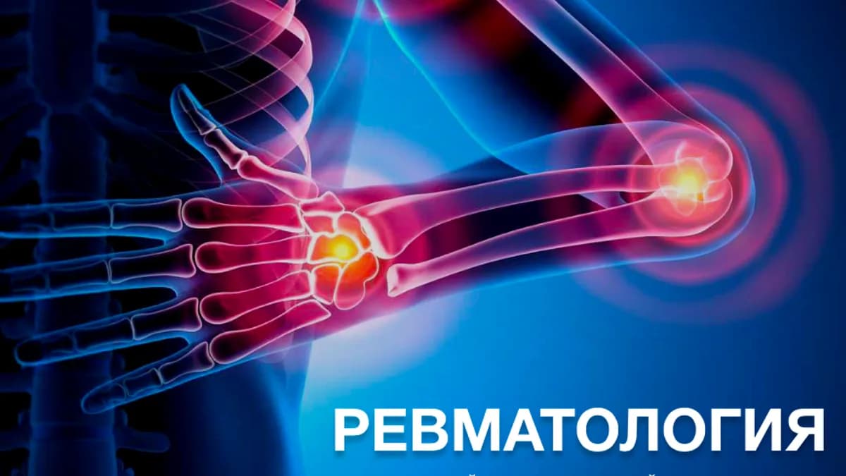 Обложка курса: Учебник по ревматологии [Synapse]. Площадка: Складчик