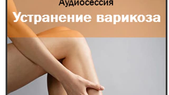 Обложка курса: Варикоз-ast. Площадка: Складчик