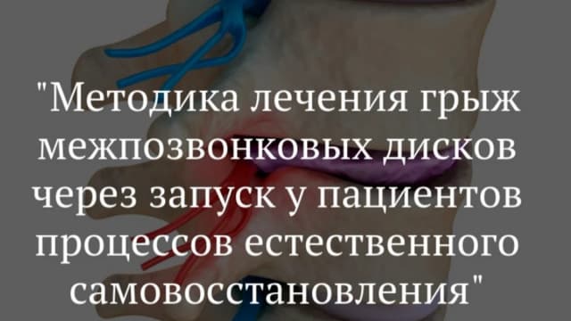 Обложка курса: Методика лечения грыж межпозвонковых дисков (Игорь Атрощенко). Площадка: Складчина.biz