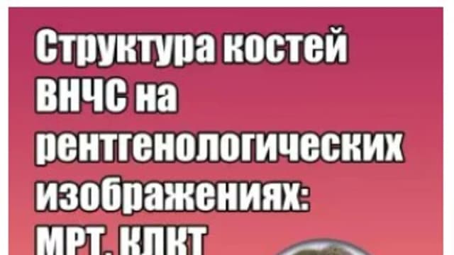 Обложка курса: Структура костей ВНЧС на рентгенологических изображениях: МРТ, КЛКТ (Грегор Славичек). Площадка: Складчина.biz